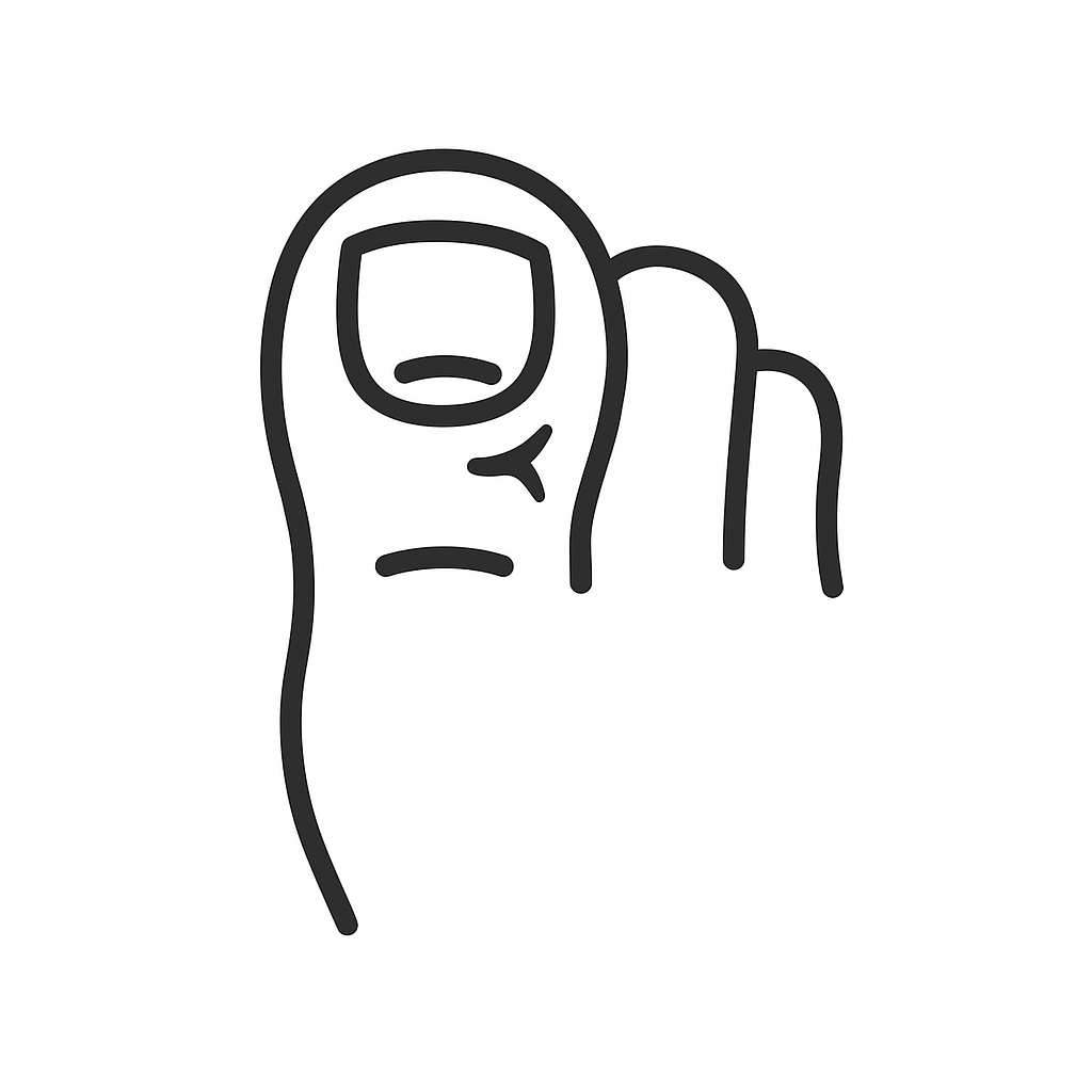 Ingrowing toenail treatment icon – domiciliary foot health services